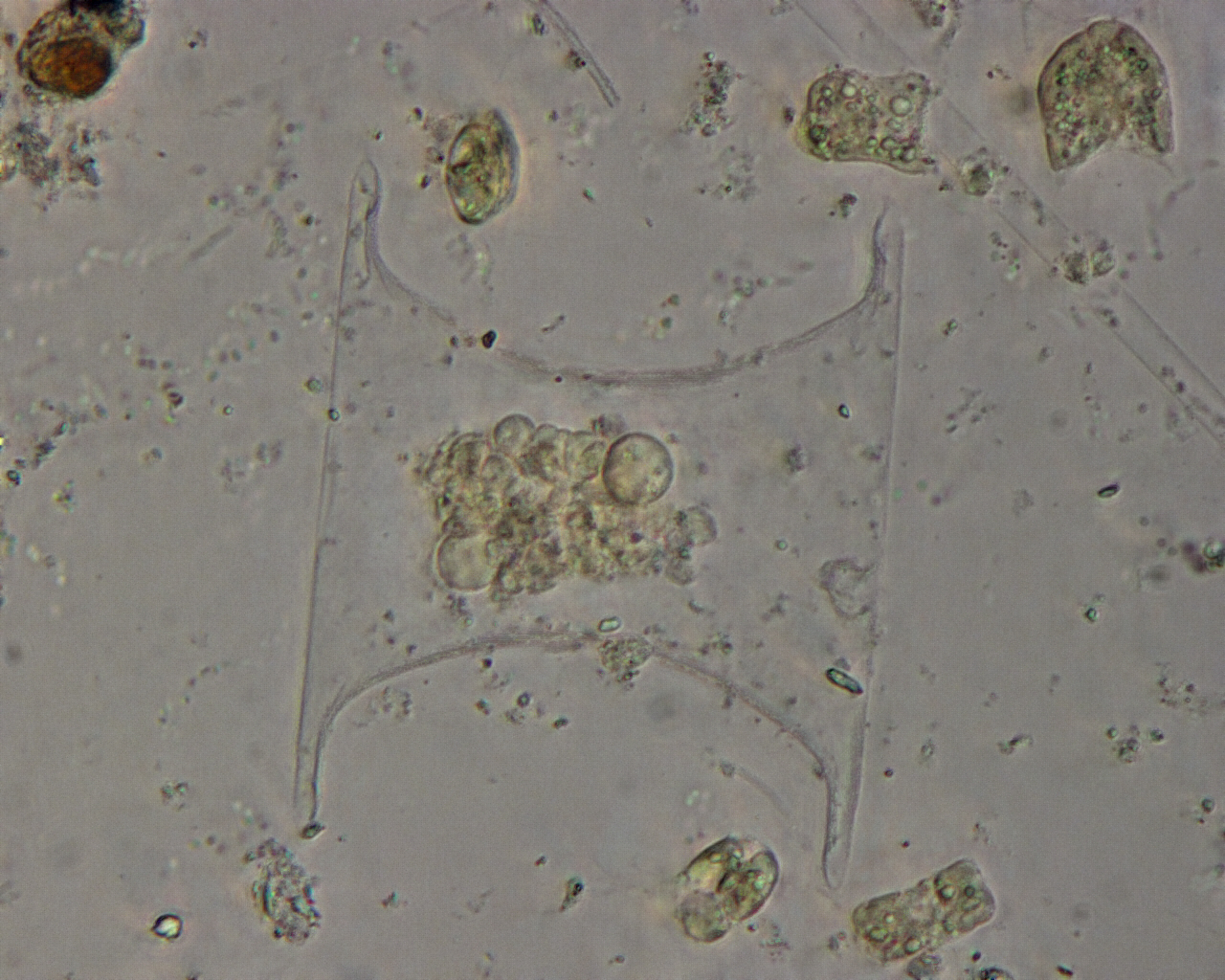 Dictyocha speculum